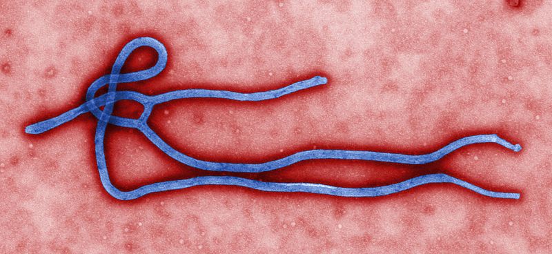 File:Ebola virus.jpg